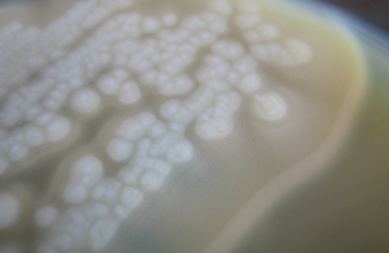 Mitos sobre la esterilización de conservas y platos preparados: erradicación del Clostridium botulinum.